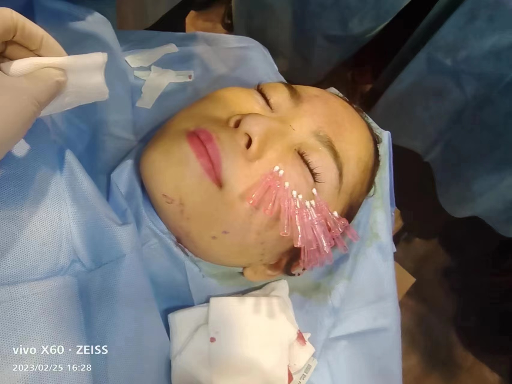 美容班.面部线雕提升培训班